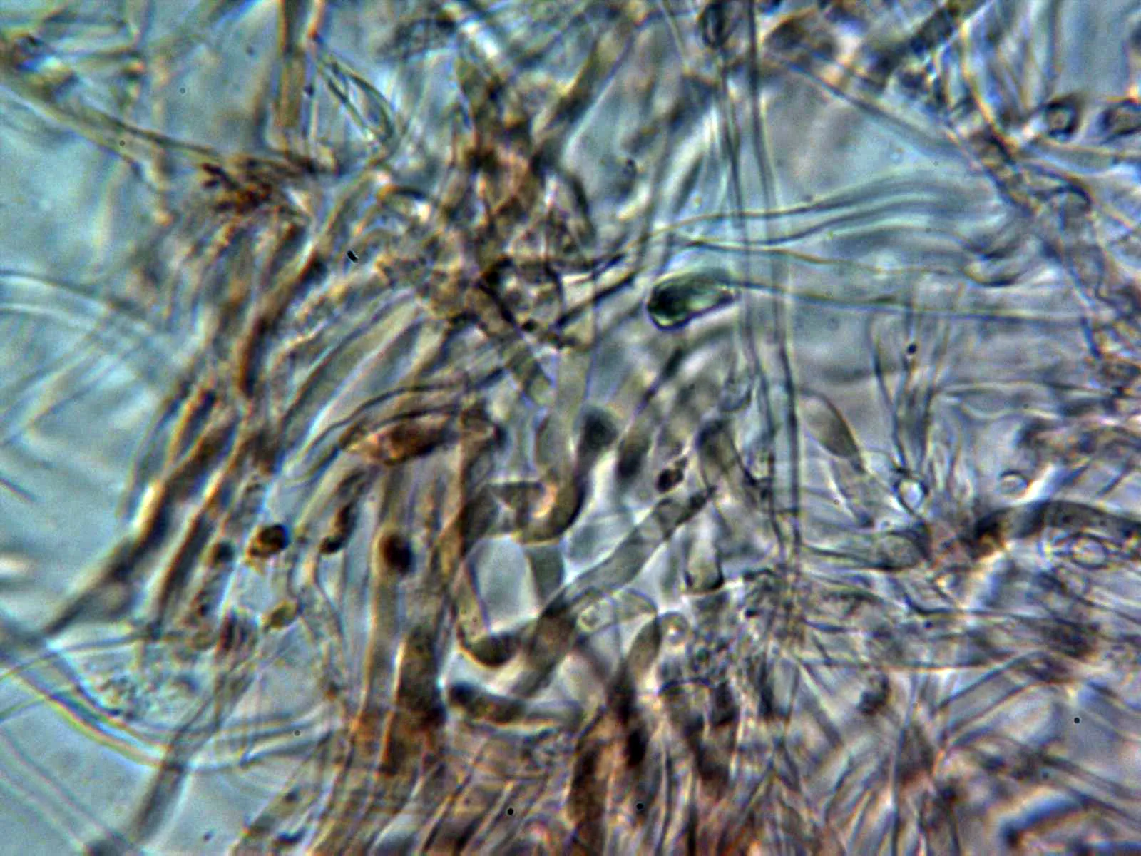 Microscopía de Plicaturopsis crispa - 22 - Cutícula filamentosa